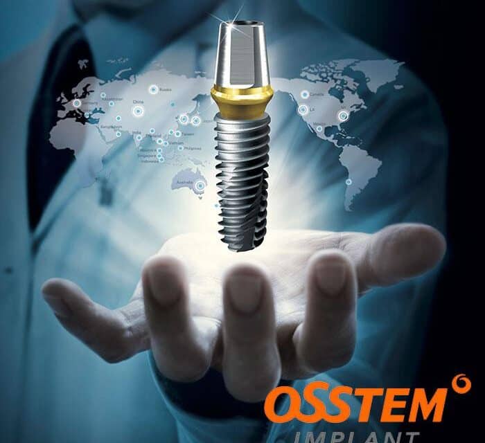 https://www.arie-stomatologia.pl/wp-content/uploads/2021/03/img-Osstem-implant-koreya-700-699-700x640.jpg
